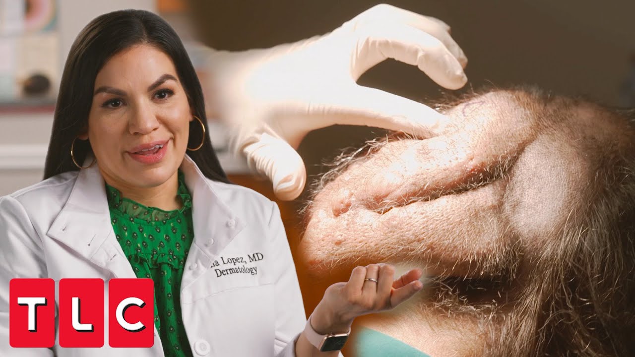 Dr. Isha Treats Massive Head Growth | Bad Hair Day - thptnganamst.edu.vn
