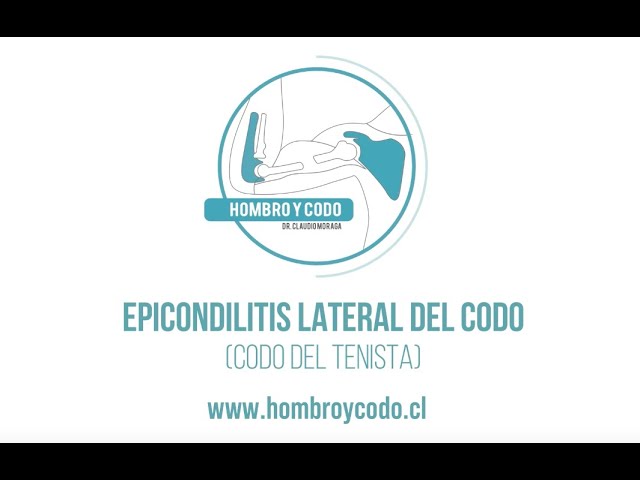 Codo: Epicondilitis lateral (codo del tenista)