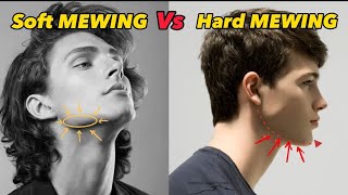 Soft Mewing Vs Hard Mewing Correct Way For Sharp Jawline