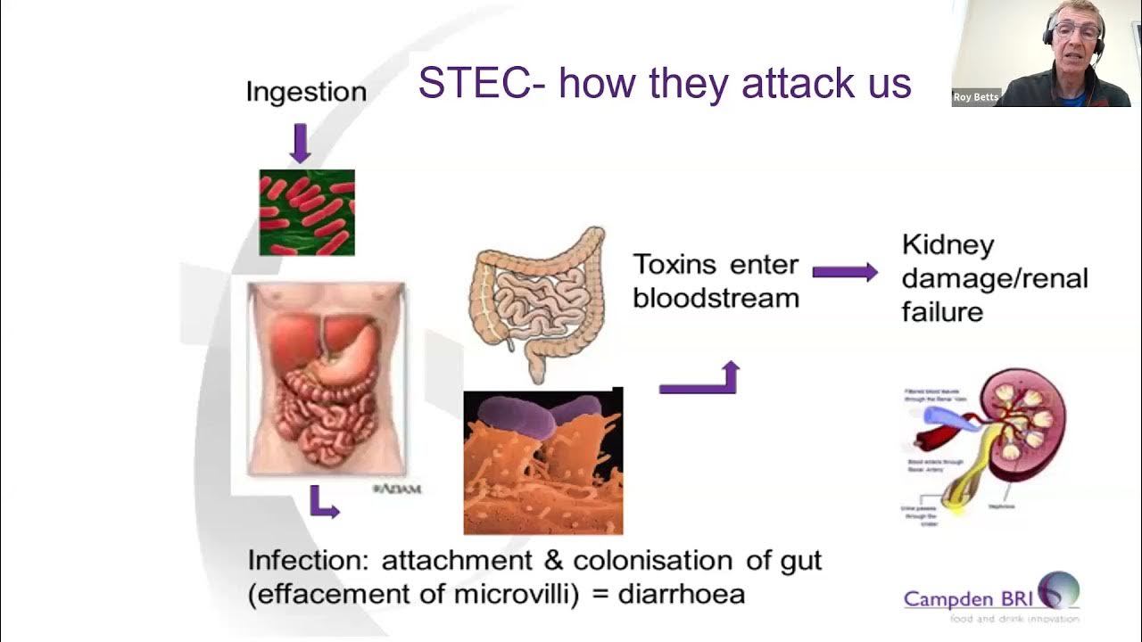 STEC (Shiga toxinproducing Escherichia coli) in food YouTube