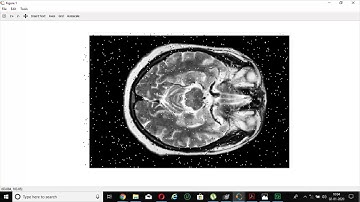 CODE IN OCTAVE/MATLAB TO IMPLEMENT NOISE IN AN IMAGE AND REMOVING IT USING FILTERING
