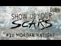 Show us your Scars: Morgan Kneisky | Cycling Weekly