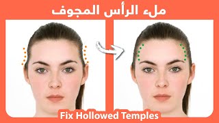 How to naturally fill hollowed or sunken temples | كيفية ملء الرأس المجوف، بشكل طبيعي