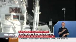 видео Что показывает общий анализ крови: основные параметры