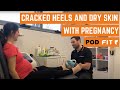 Cracked heels and dry skin with pregnancy