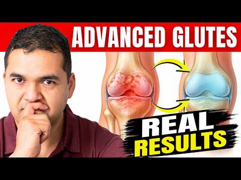 Advanced Glute Exercises to Avoid Knee Replacement (+ How to Walk Correctly)