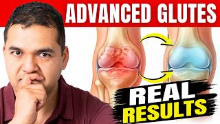 Advanced Glute Exercises to Avoid Knee Replacement (+ How to Walk Correctly)