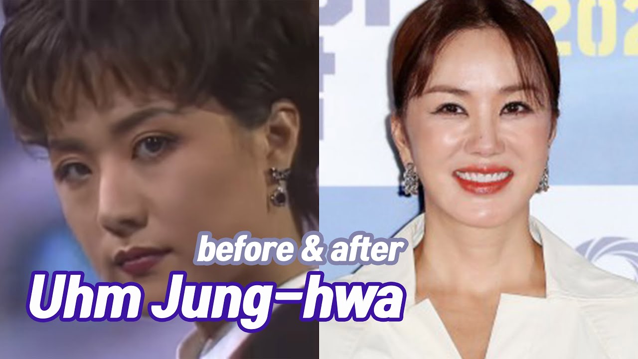 Uhm Jung-hwa before and after