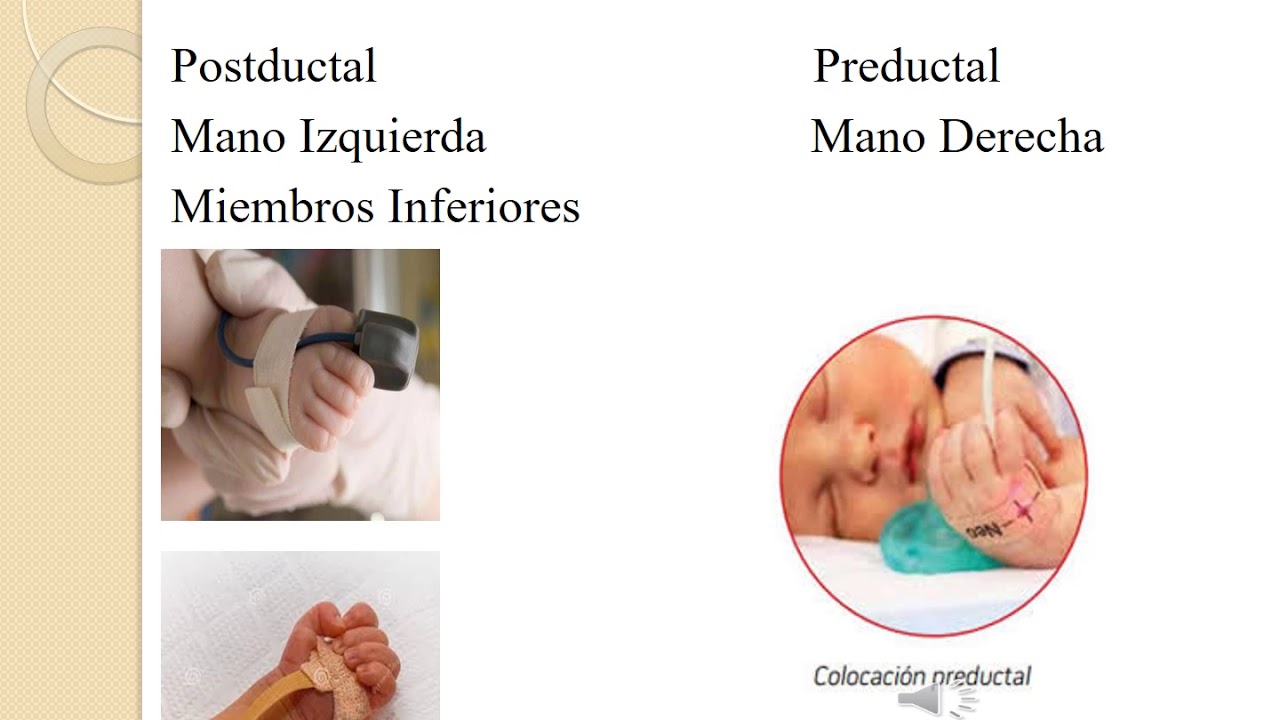 Valoración del RN Bases fisiol cap 29 Parte 1