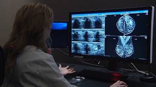 Personalized breast cancer treatment