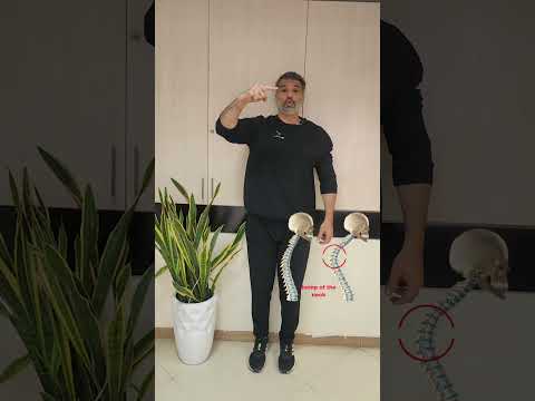 قوز گردن داری یا نه