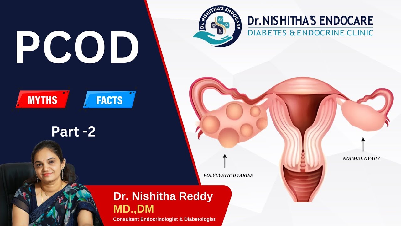 Pcod Paining Part Myths and Facts Of PCOD - Part 2 By Dr. Nishitha Reddy #pcod # ...
