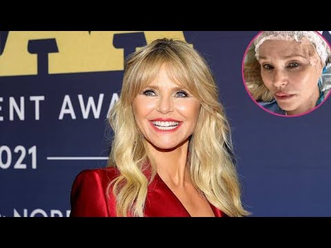 Christie Brinkley Discovered Skin Cancer Diagnosis at Daughter’s
