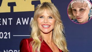 Christie Brinkley Discovered Skin Cancer Diagnosis at Daughter’s Dermatologist Appointment by United Entertainment News  69 views 4 days ago 3 minutes, 15 seconds