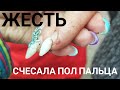Убитый палец у клиентки/Когда пол пальца отрезало/Аквариумный дизайн ногтей/Простые цветы в маникюре