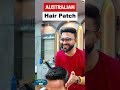Short Australian Hair patch #patch #wigs #wigsinstall #hairreplacement #kolkata #haircare #hairloss