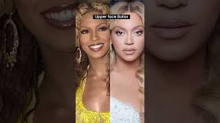 Beyoncé’s cosmetic treatments