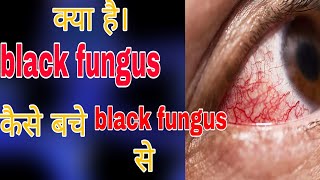 kya hai black fungus/kaise bche black fungus se/EF/