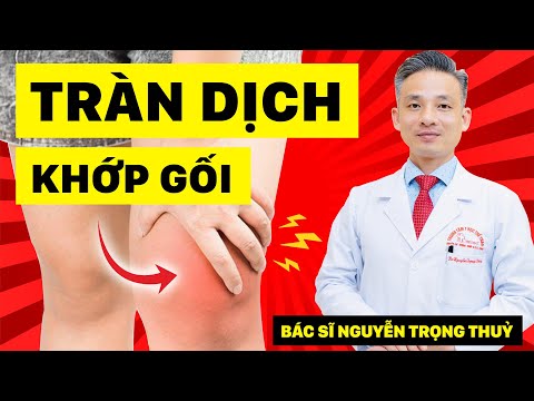 Video Tràn Dịch Khớp Gối Nguy Hiểm như thế nào và cách khắc... - YouTube