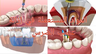 les soins dentaire:obturation de canal?(اللأدوات والمواد المستعملة في (إزالة عصب الاسنان