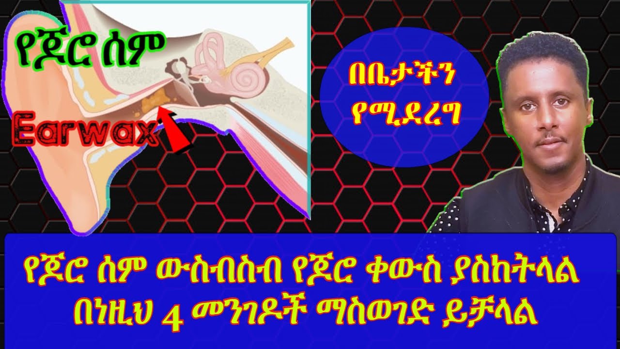 ETHIOPIA | የጆሮ ሰም (Earwax )ውስብስብ የጆሮ ቀውስ ያስከትላል  በነዚህ 4 መንገዶች ማስወገድ ይቻላል