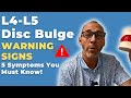 Early Warning Symptoms of L4-L5 Disc Bulge You Shouldn’t Ignore | Dr. Chris Cameron