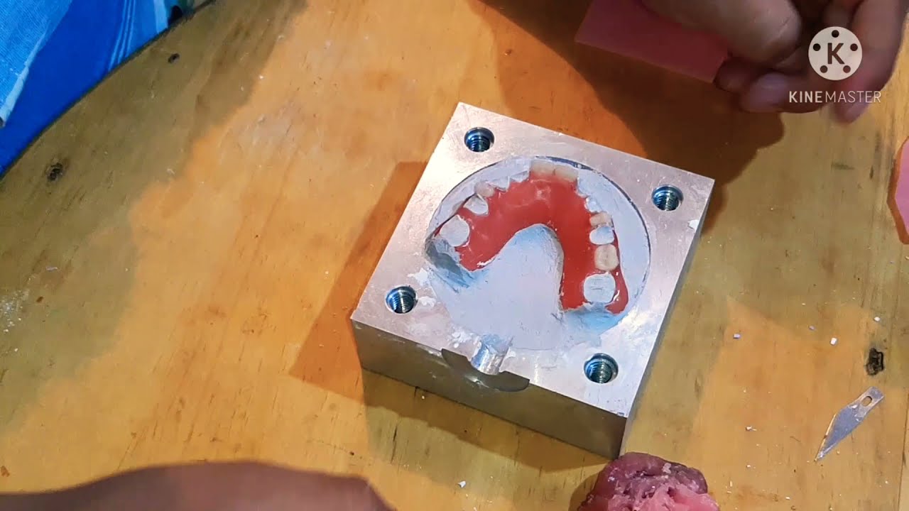 como colocar entradas para tus prótesis dentales flexibles