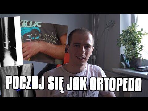 Złamanie - jak leczymy?  Ortopeda tłumaczy