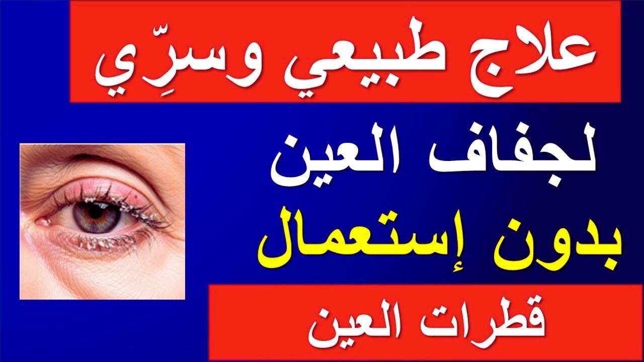 علاج جفاف العين طبيعيًا: 7 طرق بسيطة (بدون قطرات)