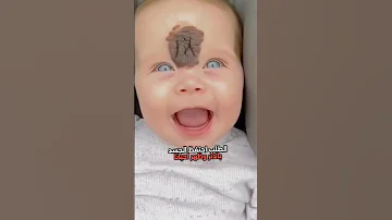 لمذا يظهر الوحم على الطفل الصغير المرأة في الإسلام اكسبلور علم النفس 