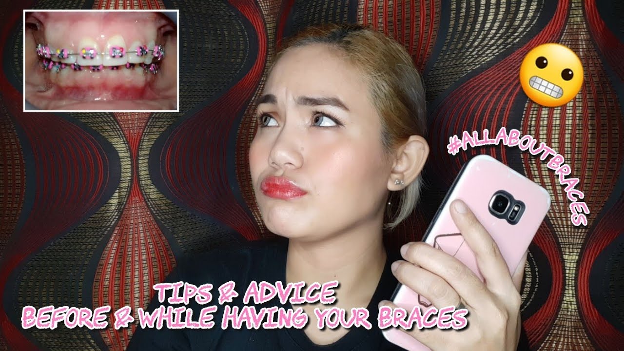 Usapang Braces Tips & Advice Before and While Having Your Braces