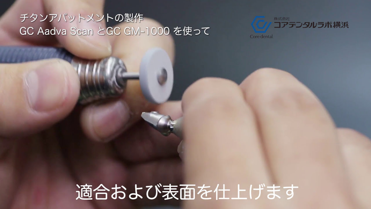 インプラントのチタンカスタムアバットメントの製作工程