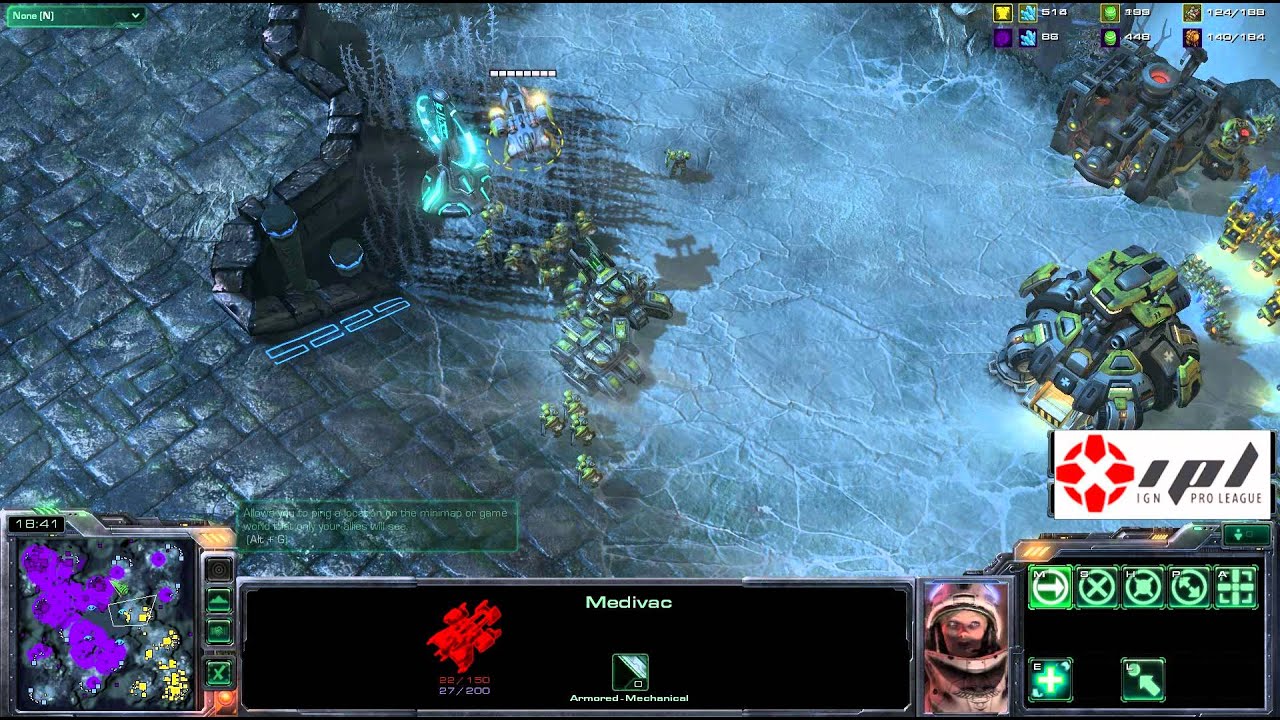 promise rings Team Arena Challenge Grand Finals set 2 g8