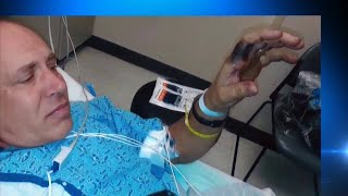 Man sues saying e-cigarette exploded causing injuries screenshot 4