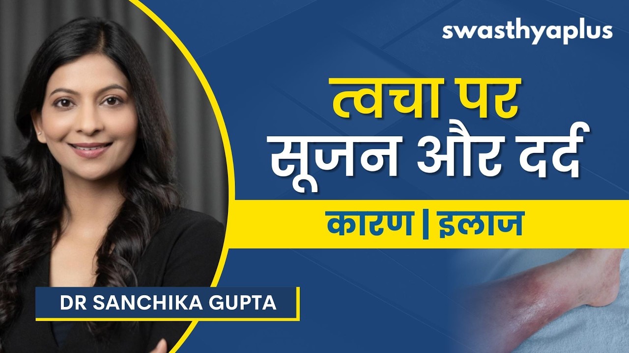 सेल्यूलाइटिस: लक्षण और इलाज | Cellulitis: Causes & Symptoms in Hindi | Treatment | Dr Sanchika Gupta