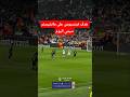 هدف ريال مدريد فينسيوس على مانشيستر سيتي اليوم