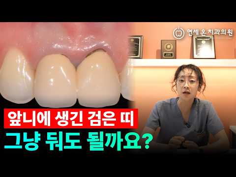 치아에 생긴 '검은 줄', 그냥 둬도 될까 | 부산치과 연세온치과의원 — 연세온치과 유튜브 영상 썸네일