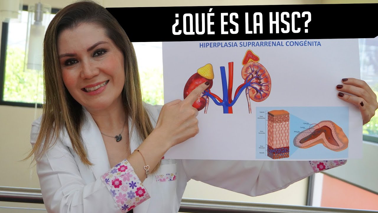 Hiperplasia Suprarrenal Congénita (Conócela) - Dra Bere