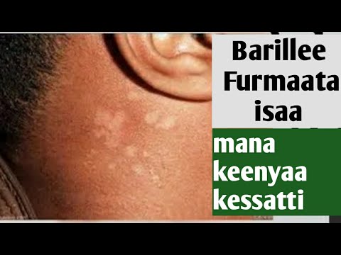 BArilleen Maalii Maalirra Dhufaa Akkamitti Mana Keessatti Ofirra Ballesiina