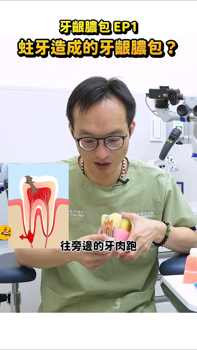 🔥蛀牙到牙齦膿包的恐怖演進！牙醫1分鐘揭密：牙髓壞死、牙齦長膿包恐需要顯微根管治療