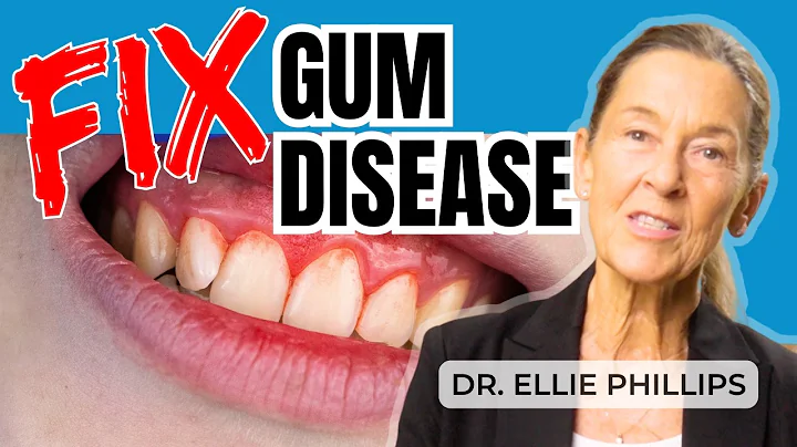 The ONE Strategy For Curing Gum Disease & Cavities