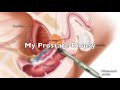My Prostate Biopsy