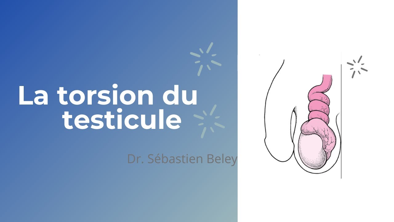 Torsion du testicule : symptômes, traitement, définition