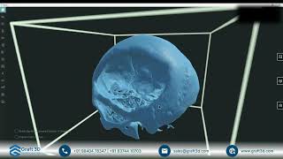 Next-Generation VR Planning for OMFS Trauma Cases | Elucis Next