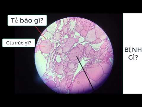 Video GIẢI PHẪU BỆNH - Ôn thi thực hành chạy trạm - youtube