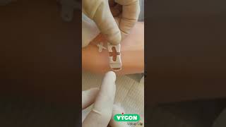 Leaderflex Dressing Change