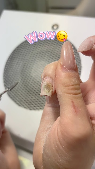 ПЛЕСЕНЬ НА НОГТЯХ 🤮🤢 #beganskayanails #ногти #история #маникюр # ...