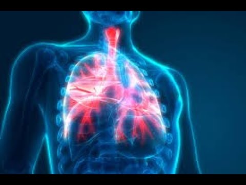 The Facts About Pneumonia Lifestylealive