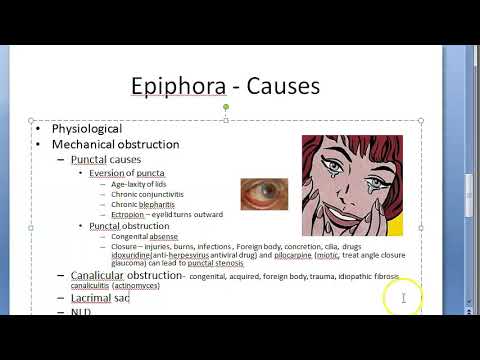 Video: Epiphora (vanning øyne): Årsaker Og Behandling