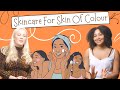 Skincare For Skin Of Colour | Brown And Dark Skincare Tips | Hyperpigmentation